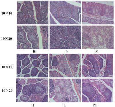 Modulation of cyclophosphamide-induced immunosuppression and intestinal flora in broiler by deep eutectic solvent extracted polysaccharides of Acanthopanax senticosus